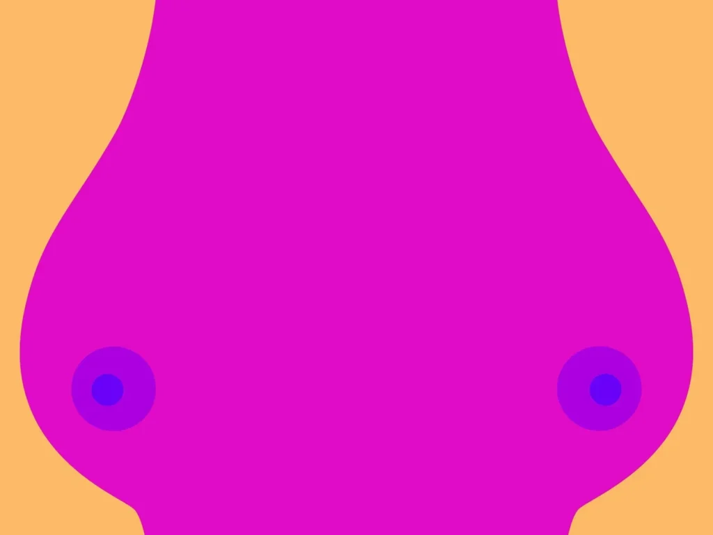 breast reduction